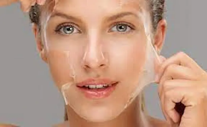 cold peeling